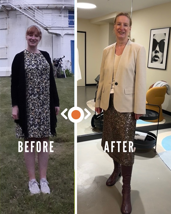 Vorher Nachher Natural Kibbe